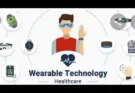 Advantages of wearable technology